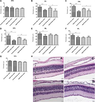 Changes in Retinal Structure and Ultrastructure in the Aged Mice Correlate With Differences in the Expression of Selected Retinal miRNAs